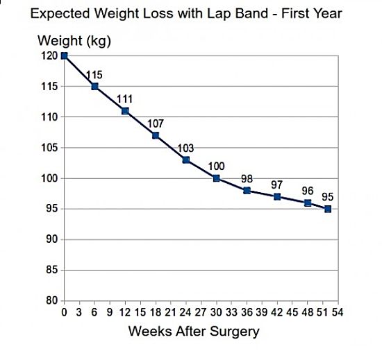 Expected weight loss rate with lap band surgery