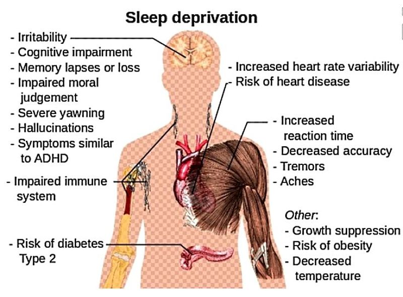 Sleep deprivation has profound and complex effects on the body