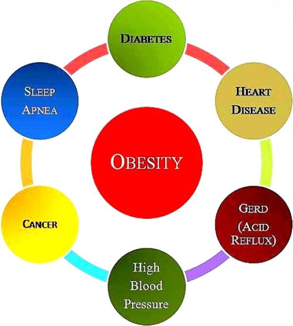 Obesity is linked to a vast array of other health problems