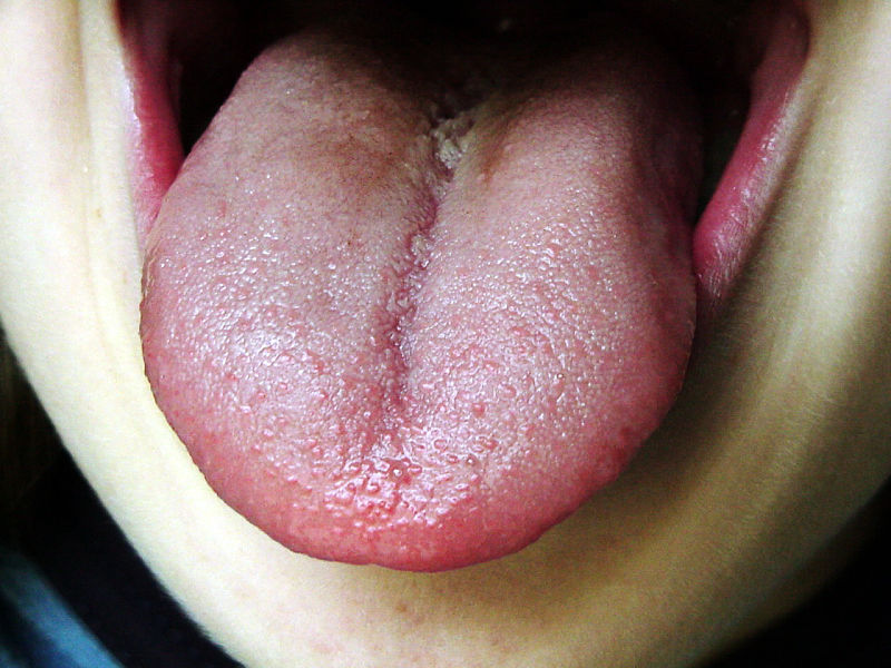 The human tongue