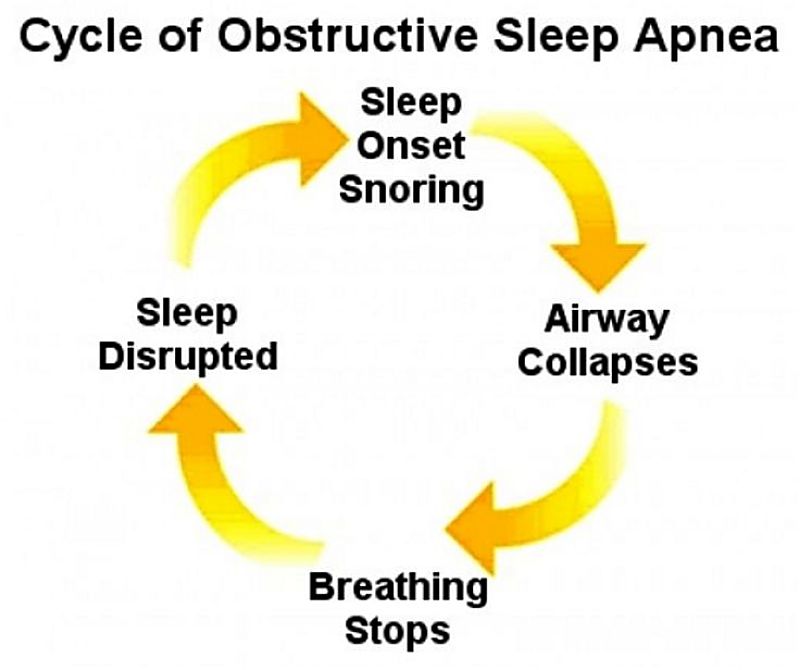 The sleep apnea cycle